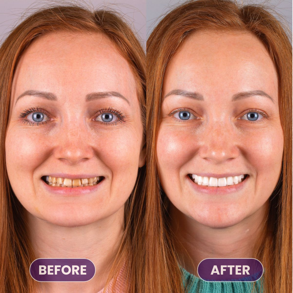 <p>Real Smiles. Real Results.</p>