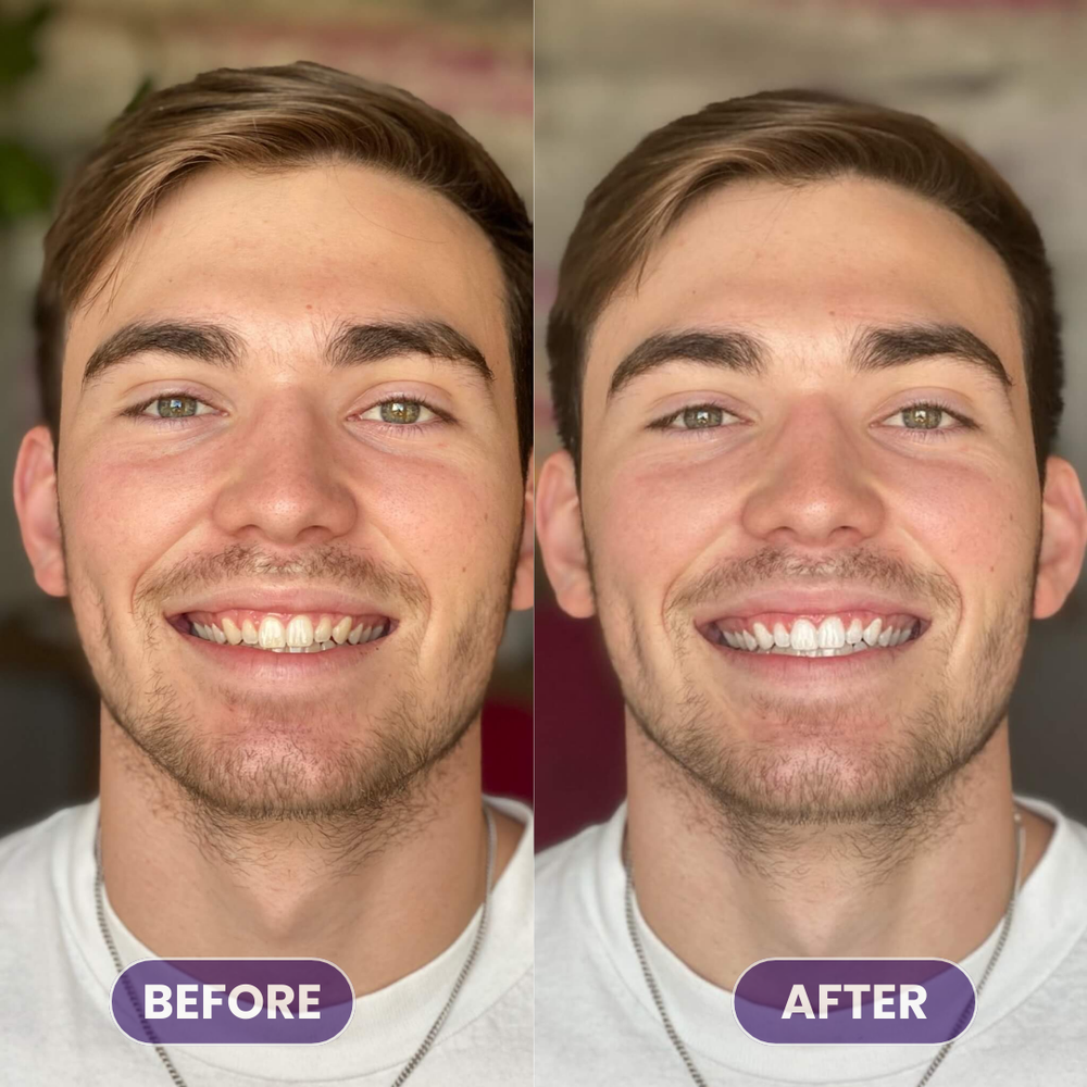 <p>Real Smiles. Real Results.</p>