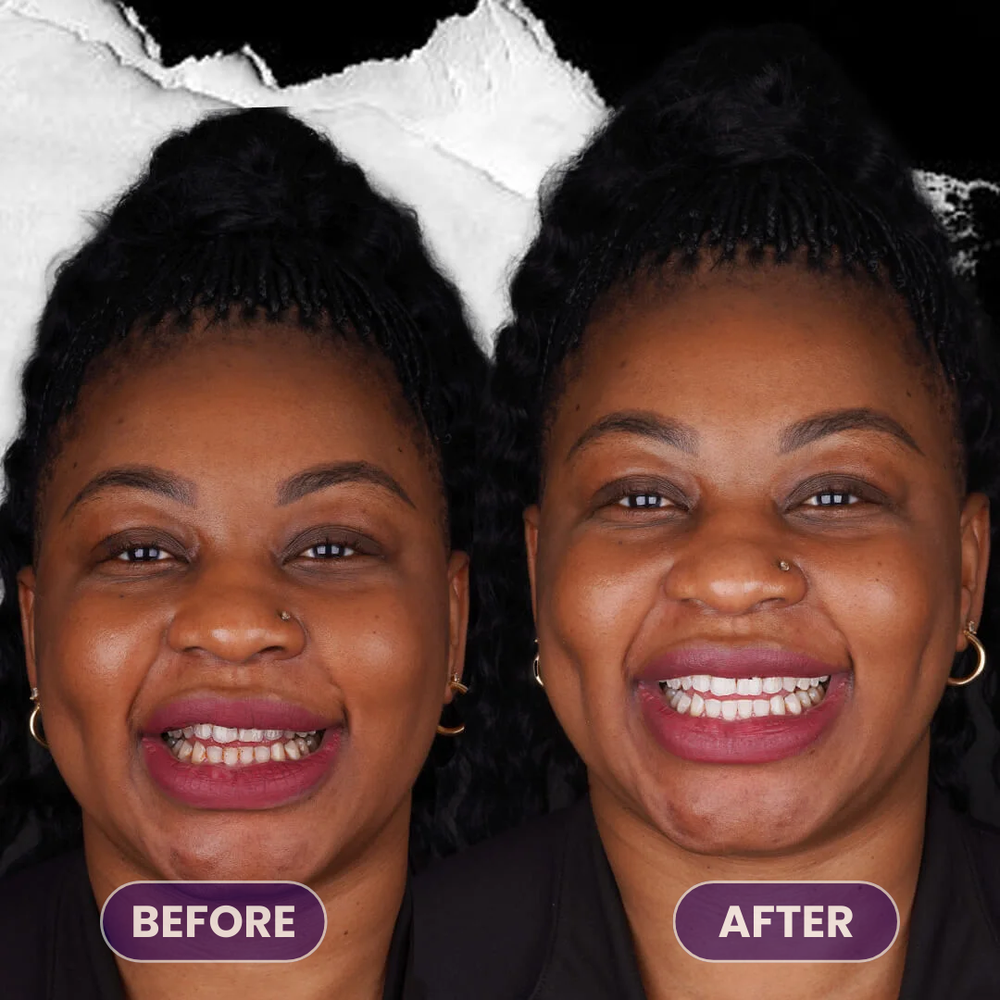 <p>Real Smiles. Real Results.</p>