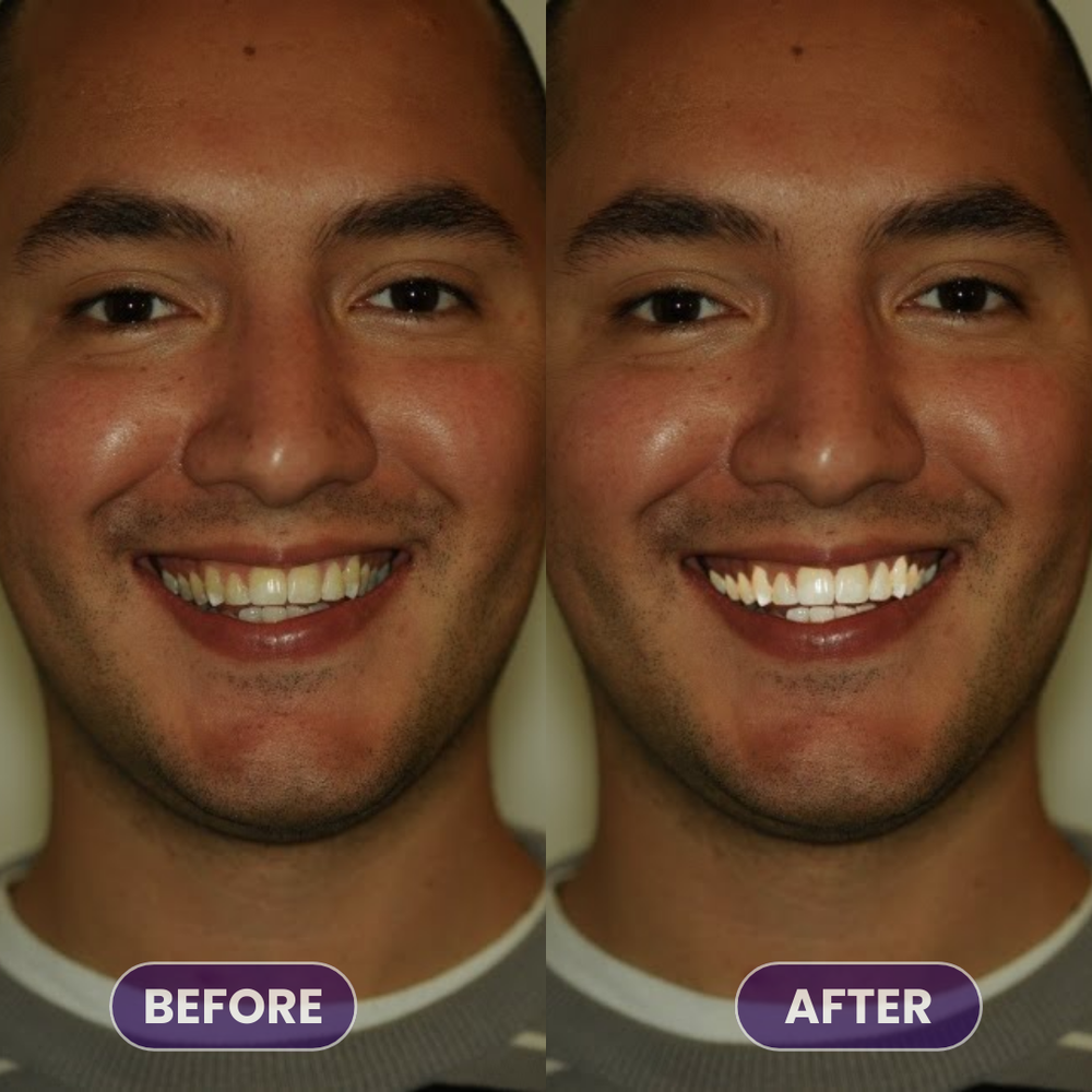 <p>Real Smiles. Real Results.</p>