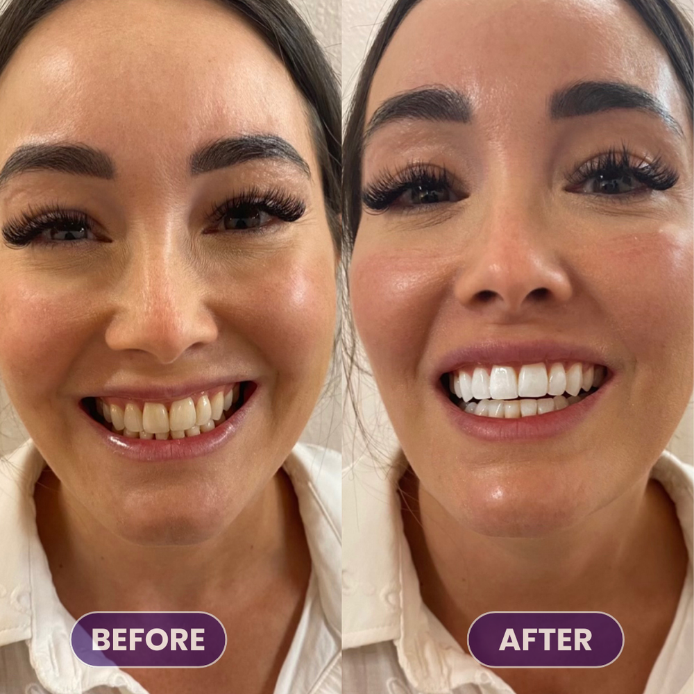 <p>Real Smiles. Real Results.</p>