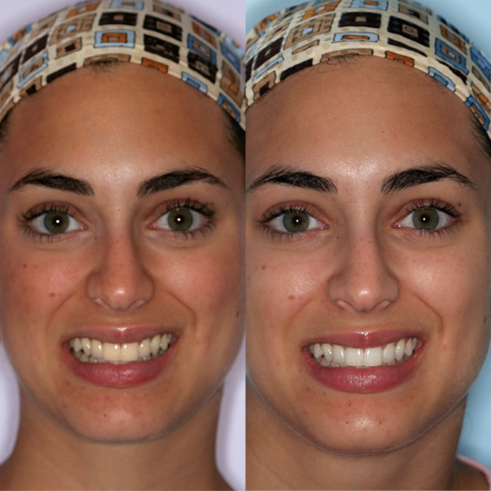 <p>They Tried It. They Loved It.</p>